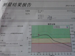 如何读懂骨密度检查报告单