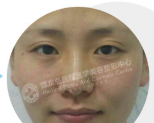 女王大人,有个补水想送给你-搜狐健康