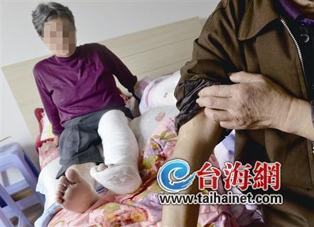 一件大事,誘發婆媳抵觸。“兒媳太不孝了。”公婆泣訴道,婆婆左腿被子婦踹得破壞性骨折,而公公左手肘則腫得像饅頭高。“我冤枉呀!”子婦徐密斯則喊冤,宣稱是公公先入手打她,她的頭皮也腫了。至于為什么婆婆會骨折、公公手肘紅腫等受傷成績,子婦示意“不分明”。