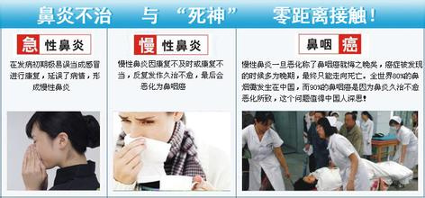 鼻炎的各种治疗方法利弊解析