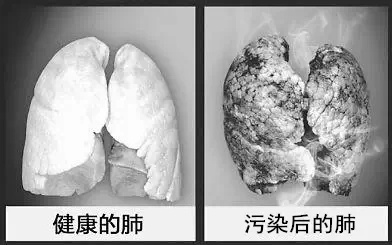 雾霾肺部实验报告及生存手册