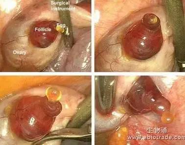 分泌物病原体检查