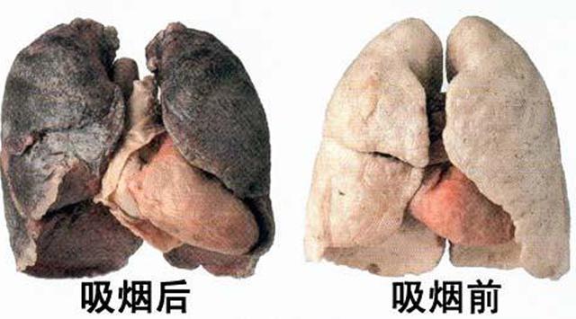 我们的肺是什么颜色的不太好确认,但是我们的肺功能如何可是很容易测试到的哦,不需要跑医院,自己在家就可测试。