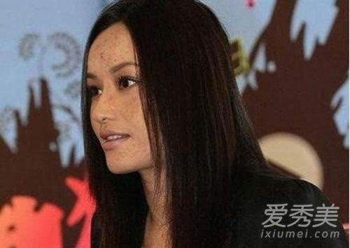 盘点素颜皮肤差的女明星 干纹痘痘吓死人!
