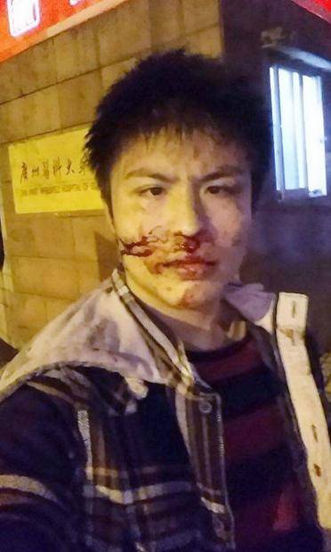 “骂内地人”香港男子自称在广州被围殴(图)