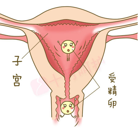 生化妊娠就是精卵已经结合,但是没有回到子宫,或回到子宫没有着床就