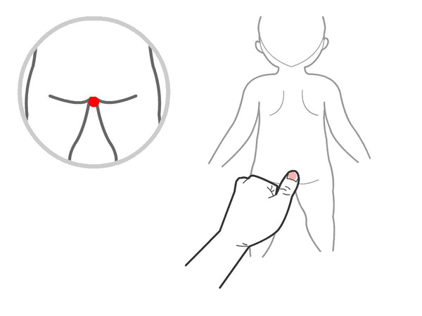 小儿便秘的推拿图解