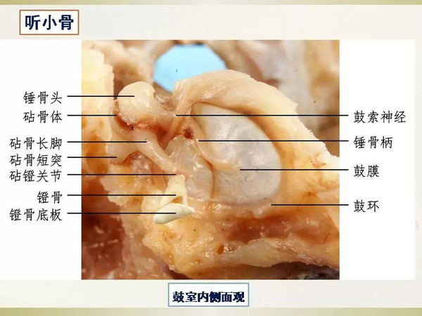 颞骨解剖学习曲线及耳后入路解剖简述2