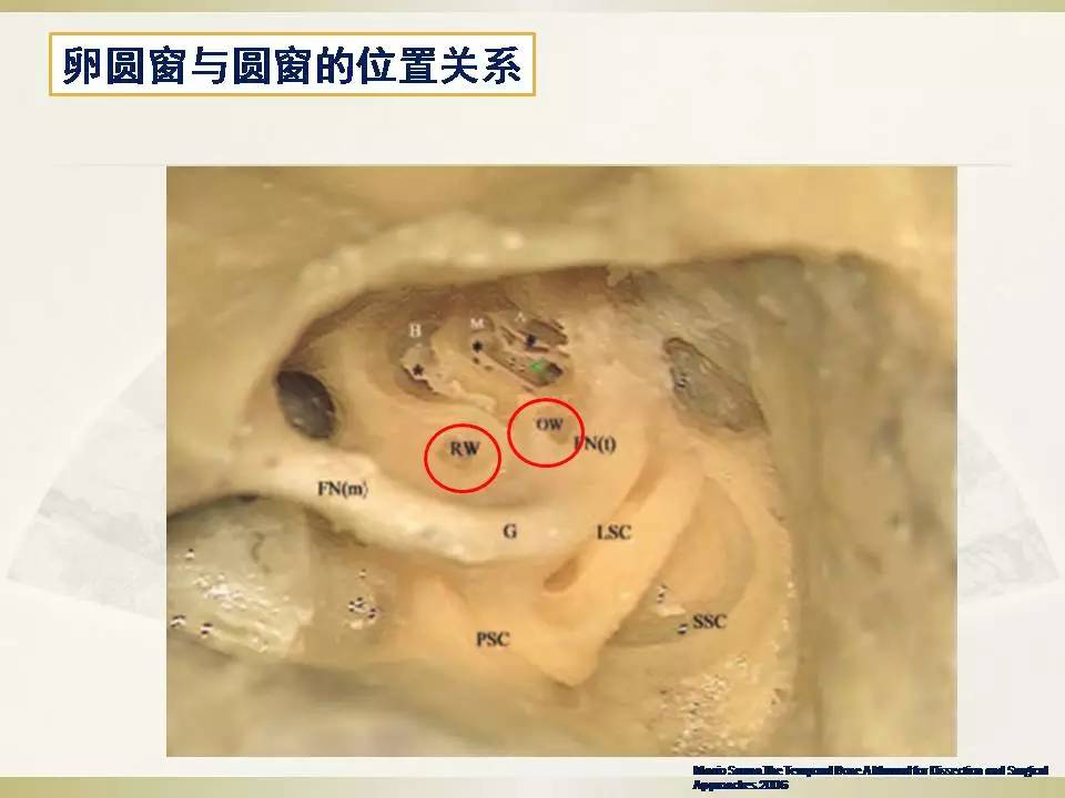 颞骨解剖学习曲线及耳后入路解剖简述-2