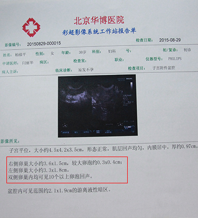 多囊卵巢综合征 北京华博医院提醒早发现早治