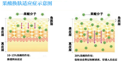 美肌养成:揭开果酸换肤神秘面纱