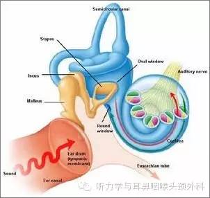 解放军总医院戴朴教授微创保留残余听力的人工耳蜗植入术