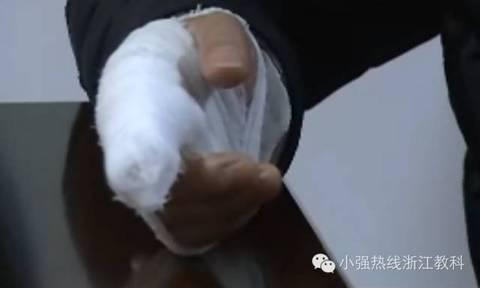 男子要求足浴店为其洗手 手指被洗坏或面临截肢