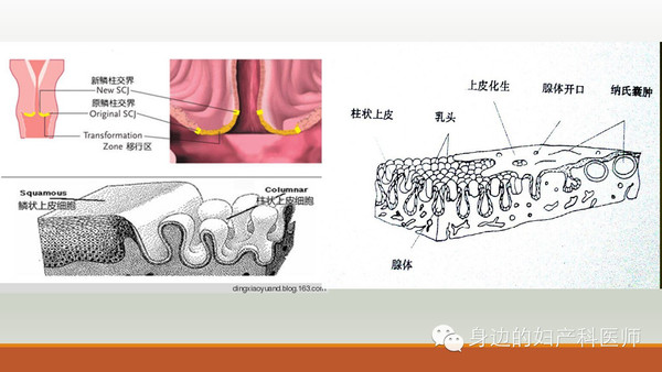 宫颈癌的预防