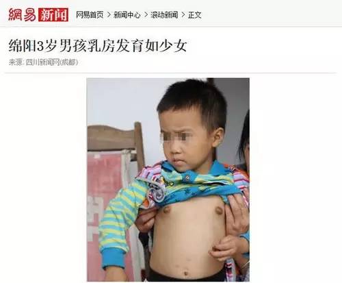 如下面的男孩,年仅3岁乳房便开始发育