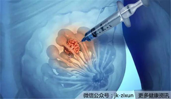 乳腺结节穿什么内衣好_乳腺结节图片