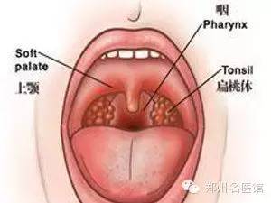 小儿喉炎凶猛02儿童医院一夜接收20多人