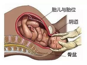 芈月生孩子表情痛苦 分娩到底有多痛?