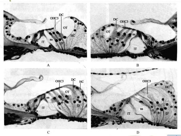 耳蜗解剖和生理三