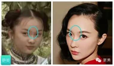 拔牙鼻子?早餐捏高?整形贵圈谎言戳破瘦脸减脂女星喝蛋白粉图片