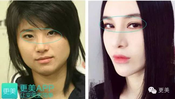 【组图】拔牙能瘦脸?鼻子能捏高?戳破贵圈女星整形谎言