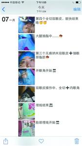 朋友圈微整形乱象:女子花2800元纹眉 当场飙血