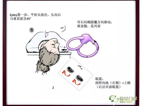 长安眩晕讲堂精品课件良性阵发性位置性眩晕