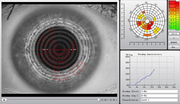katetograph干眼症最新综合分析检查仪