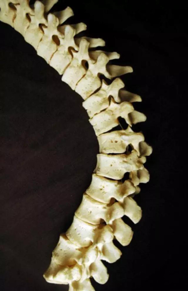 这根人类的脊椎骨,售价1400美金