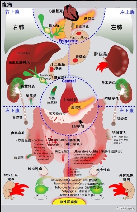 腹痛的部位提示疾患所在的可能