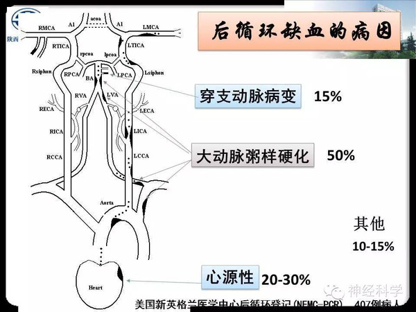 【长安眩晕讲堂精品课件】后循环缺血