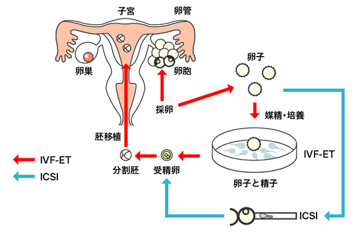 泰国试管婴儿一个周期需要多长时间?