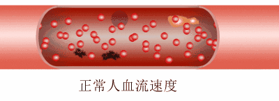 体循环动脉血压简称"血压".