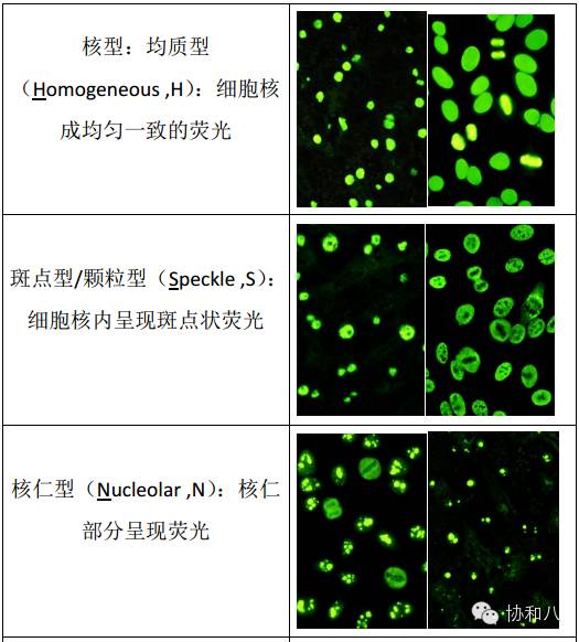 如何才能读懂你我的抗核抗体丨一页手册协和八