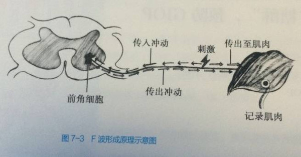 年轻医生快来看学习一下如何读懂肌电图