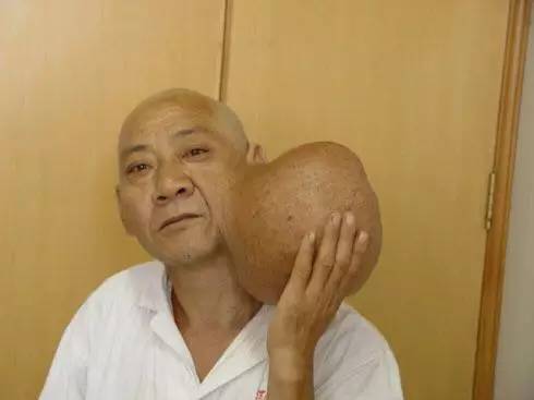 被春晚吉祥物丑哭了,那谜一样的「耳下两坨」难道不是腮腺肿瘤?