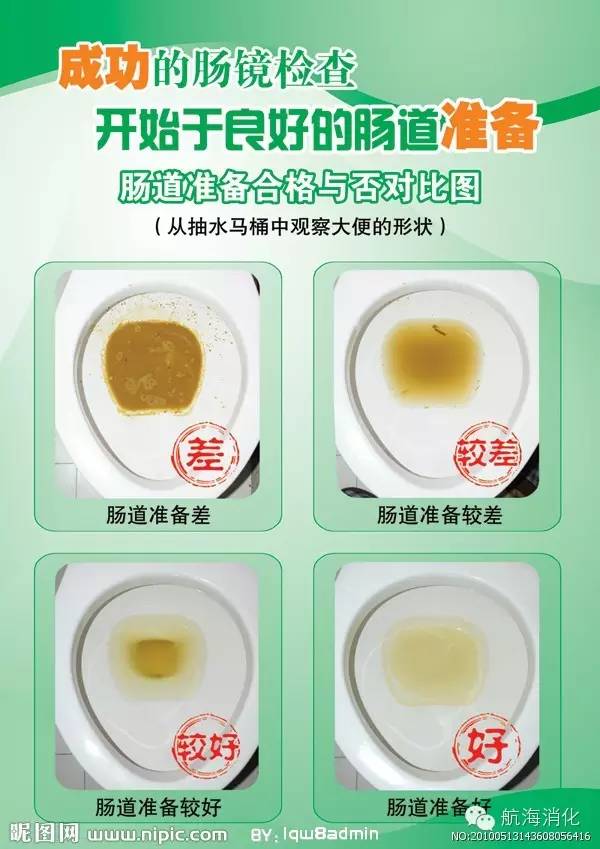 如何做到肠镜检查前高质量肠道准备?,肠镜检查前一天吃什么,做肠镜检查过程视频,检查肠道必须做肠镜吗,做肠镜检查大约需要多