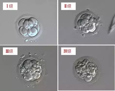 试管婴儿过程中,女性的身体对胚胎着床影响很大,男性朋友的精子质量
