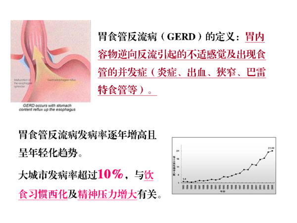 胃食管反流病,您需要知道的那"一"些