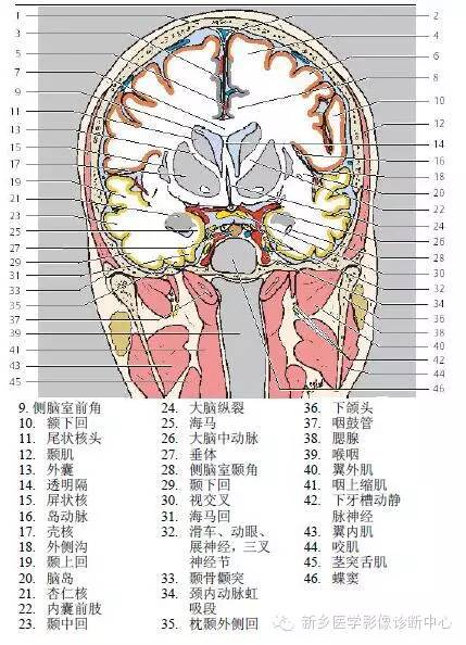 高清头部冠状位解剖加标注,大冷天的,适合用来热热脑.
