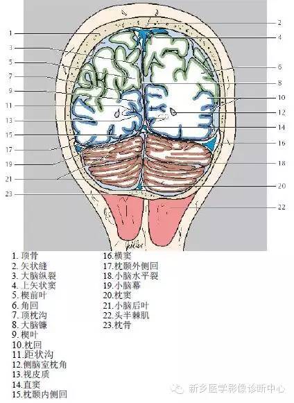 高清头部冠状位解剖加标注,大冷天的,适合用来热热脑.