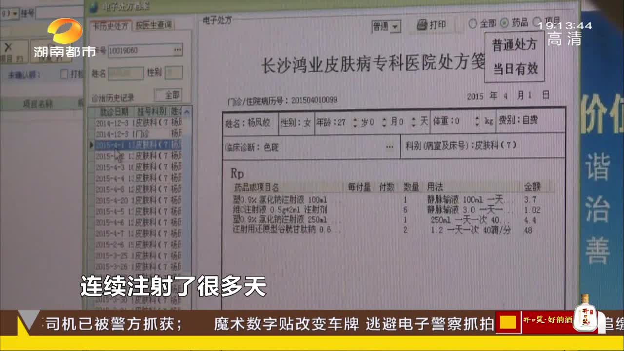 28岁女子面部遇热红肿医生诊断过敏性皮炎