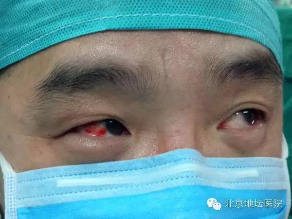 走下手术台,护士发现冯恩山的眼睛充满血丝 新年第一天,连夜紧急购药