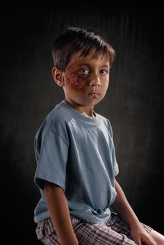 儿童疤痕修复需要的注意事项