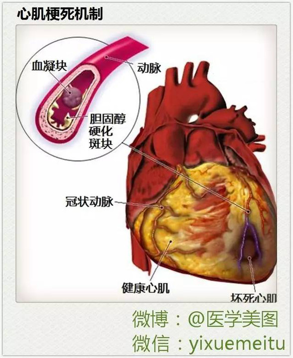 55张医学美图讲述各种心脏疾病