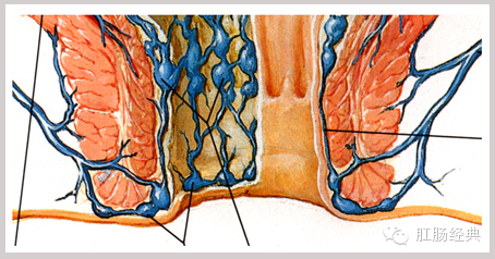 图说痔疮
