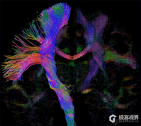 成像算法连接fods,从而尽可能地模拟大脑神经纤维经过视交叉的路径
