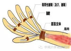 严重的甚至连拿筷子吃饭都困难,这就可能患上了 腱鞘炎