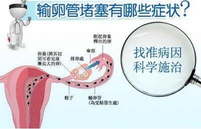 【日本好孕网】女性输卵管堵塞的罪魁祸首是什