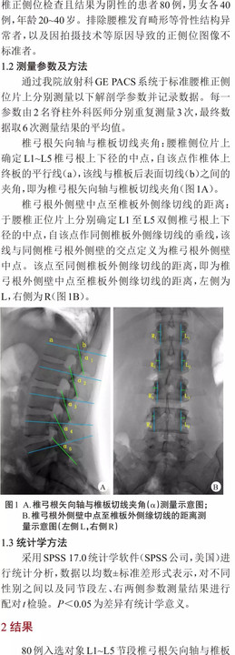 【玖玖学术园地】腰椎椎板-椎弓根解剖参数的影像学测量及临床意义